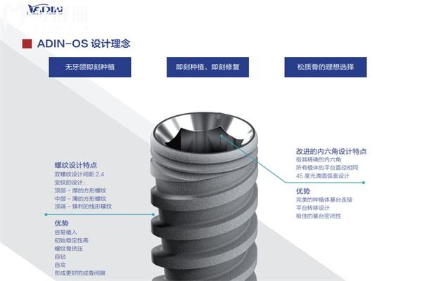 以色列雅定種植牙是什么檔次?韓國的植體比哪種好?多少錢一顆?