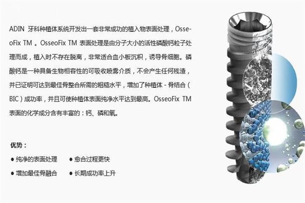 以色列雅定種植牙是什么檔次?韓國的植體比哪種好?多少錢一顆?