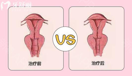 武漢私密整形價格表