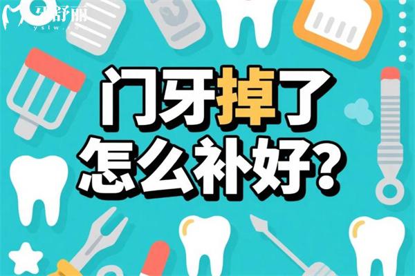 門牙掉了怎么補(bǔ)好?門牙缺失好的修復(fù)方法有哪些?門牙掉了怎么辦看過便知!