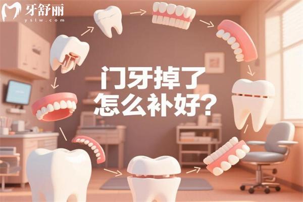 門牙掉了怎么補(bǔ)好?門牙缺失好的修復(fù)方法有哪些?門牙掉了怎么辦看過便知!
