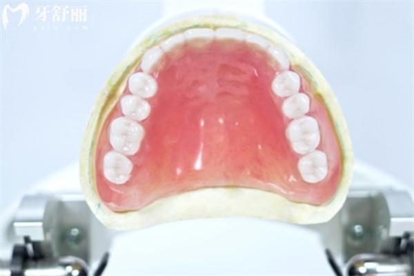 北京吸附性義齒哪家醫(yī)院可做?對比價格費用/技師水平/患者口碑這幾家可選
