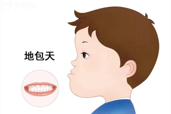 地包天換牙后能自己變正常嗎