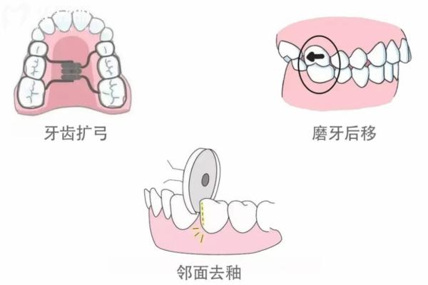 2025哈密**排名前十:細(xì)數(shù)五家牙科的技術(shù)絕活種牙矯牙這樣選就對(duì)了！