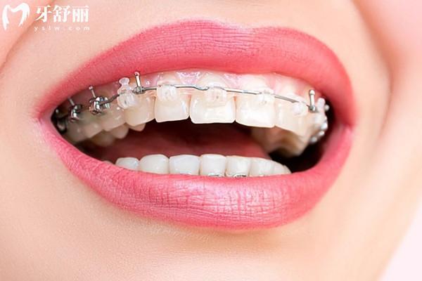 杭州口腔醫(yī)院收費(fèi)標(biāo)準(zhǔn)