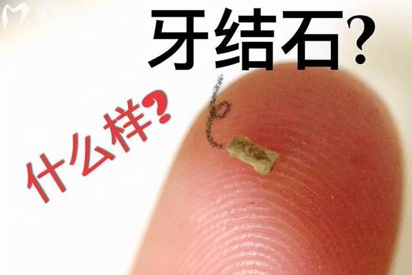 杭州口腔醫(yī)院收費(fèi)標(biāo)準(zhǔn)
