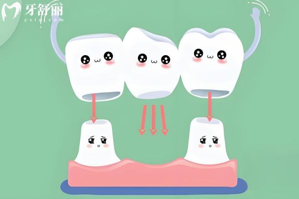 北京三里屯附近的牙科診所:當(dāng)?shù)厝送扑]的三大牙科診所公開,種牙/矯正/補(bǔ)牙技術(shù)穩(wěn)/收費透明