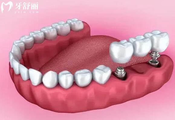 【在線查詢】南**腔醫(yī)院收費(fèi)明細(xì):美白580元起