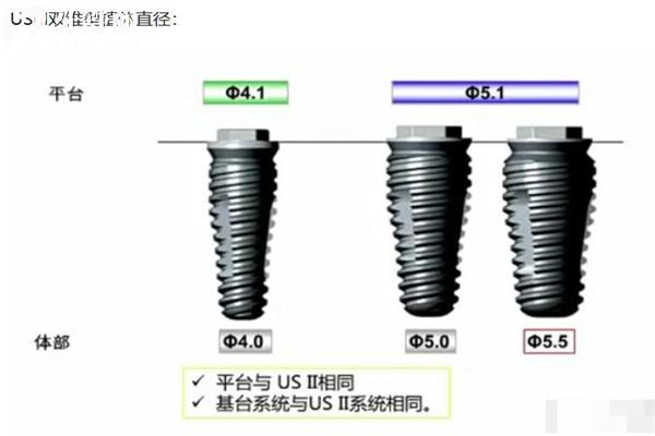 奧齒泰種植體型號和規(guī)格表大全:四大系列滿足不同患者種植需求