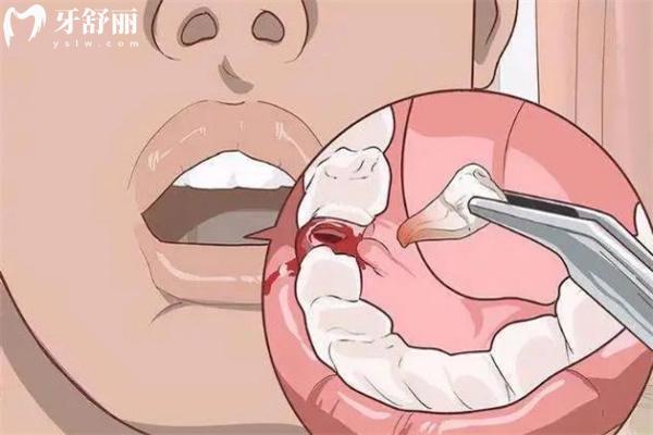 杭州看牙需要多少錢?全新的杭州牙科收費(fèi)價(jià)目表含種植牙