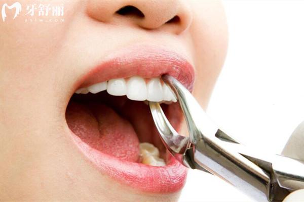 珠海牙科醫(yī)院收費(fèi)價(jià)目表