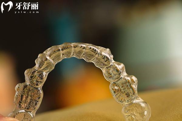 麗綺美隱形矯正