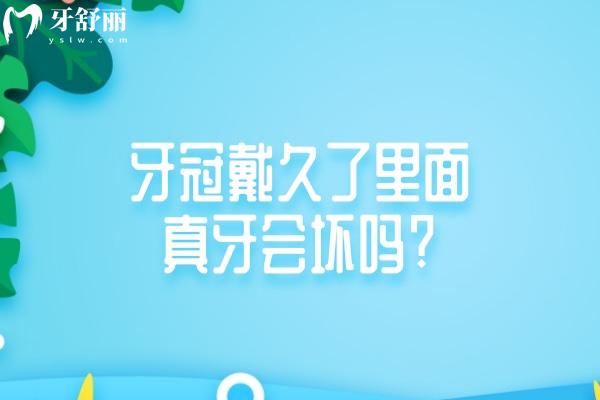 牙冠戴久了里面真牙會壞嗎?盤點牙冠一般壽命是多久及牙冠更換周期建議