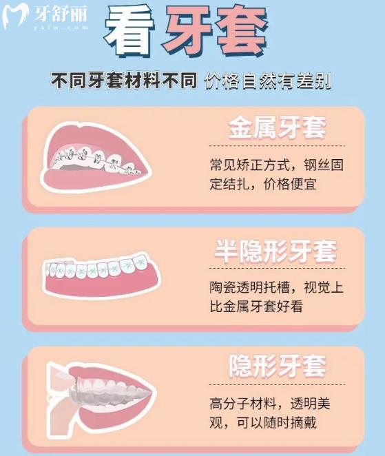 2025青少年牙齒正畸大概收費(fèi)標(biāo)準(zhǔn)參考:簡單病例5k+復(fù)雜病例1.2w+隱形更貴