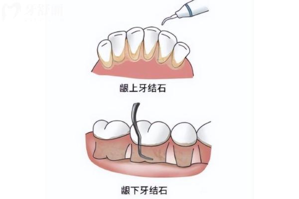 啟辰口腔連鎖收費價目表