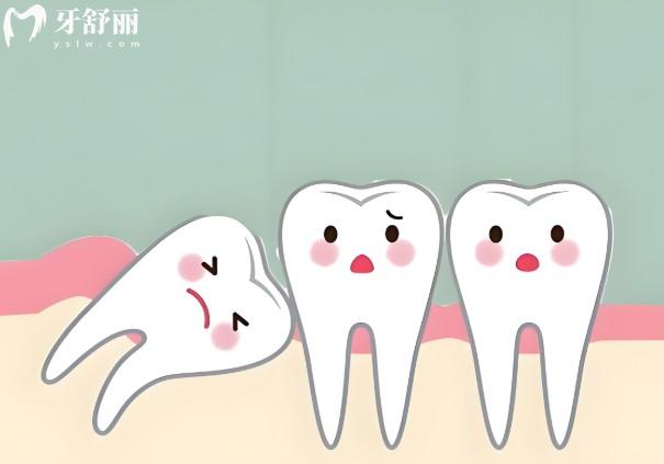 埋伏牙與阻生牙的區(qū)別在哪?還有相對(duì)應(yīng)的治療方案及術(shù)后注意事項(xiàng)分享