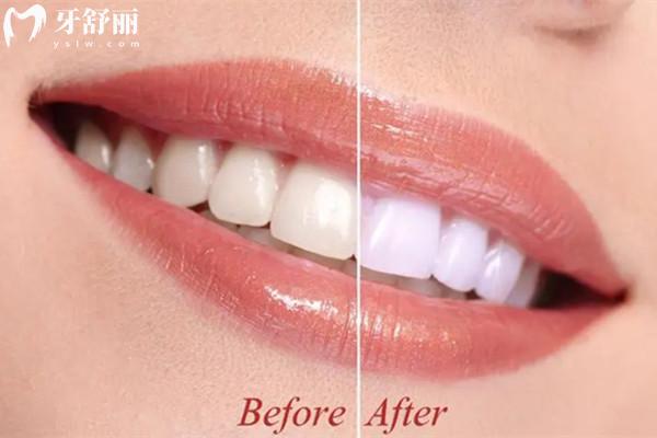 綿陽牙科醫(yī)院收費(fèi)標(biāo)準(zhǔn)