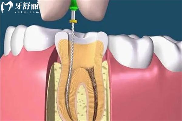 2026樂山口腔醫(yī)院價(jià)格表超全版奉上!含種植牙/牙齒矯正/鑲牙修復(fù)/補(bǔ)牙洗牙等收費(fèi)標(biāo)準(zhǔn)