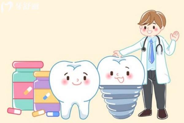 中山貝殼口腔種植牙多少錢