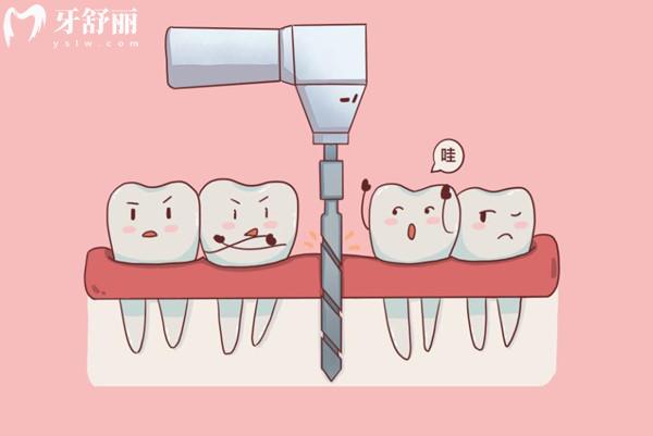 市場上高端種植體有哪些品牌？