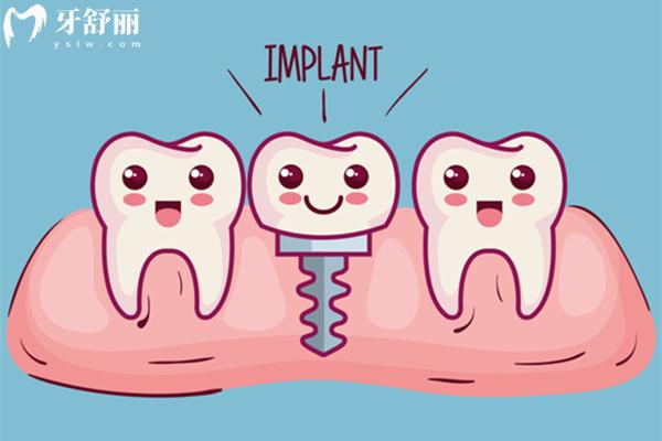 市場上高端種植體有哪些品牌？