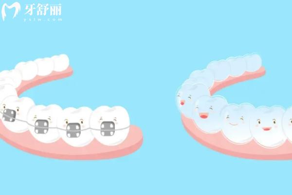 2026廣安整牙齒要多少錢