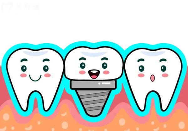 瑞士iti悅鋯屬于什么檔次?中高端檔次,親水植體,技術(shù)優(yōu)勢及價格分享