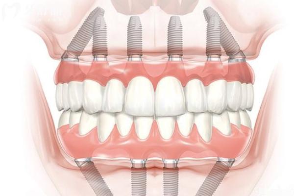 汕頭口腔醫(yī)院價(jià)格表還有排行榜前十