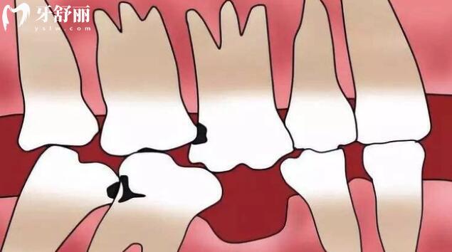 2026浙江省口腔醫(yī)院收費(fèi)價格表搶先看!種植牙,拔牙,補(bǔ)牙,正畸,美白,全瓷牙收費(fèi)均可一鍵查詢