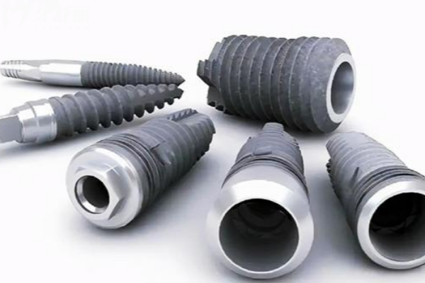 2026種植牙收費價目表