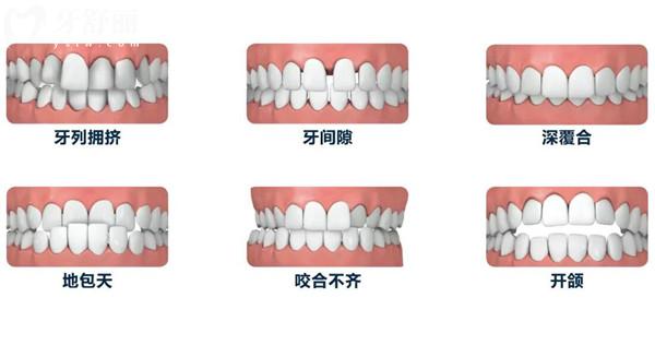 2026營口團(tuán)圓口腔醫(yī)院收費(fèi)標(biāo)準(zhǔn):種植牙價(jià)格2456~8000起，矯正、補(bǔ)牙、拔牙價(jià)格全公開