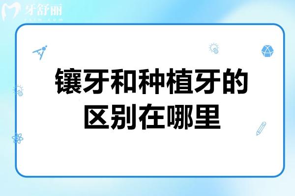 鑲牙和種植牙的區(qū)別在哪里？哪個(gè)會(huì)更好？速看修復(fù)原理/舒適度/價(jià)格硬核對(duì)比！