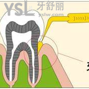 廈門登特口腔消炎藥派麗奧多少錢一支？