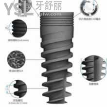 請問鄭昌昊醫(yī)生種植體以色列科特斯種植系統(tǒng)好嗎？有什么優(yōu)勢？