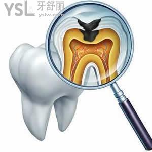 天津愛(ài)齒口腔舒適拔牙雙11優(yōu)惠價(jià)格
