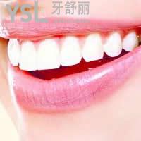 天津愛(ài)齒口腔皓齒美白牙齒雙11優(yōu)惠價(jià)格