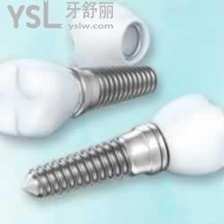 北京維恩口腔韓國紐白特種植體+基臺+牙冠多少錢？
