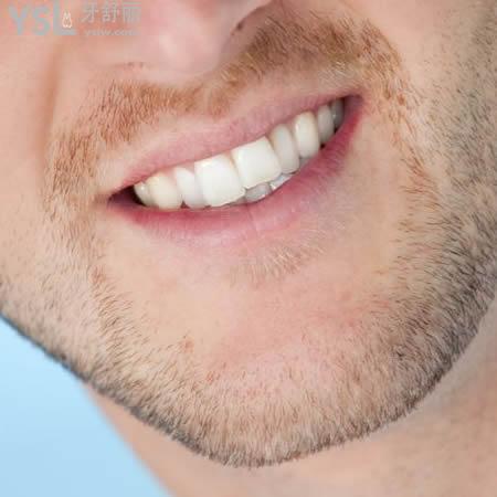 廣州曙光醫(yī)院口腔中心國(guó)產(chǎn)鋼絲美學(xué)矯正價(jià)格表