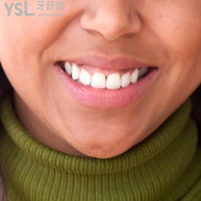 北京瑞泰口腔醫(yī)院金屬托槽矯正收費(fèi)標(biāo)準(zhǔn)