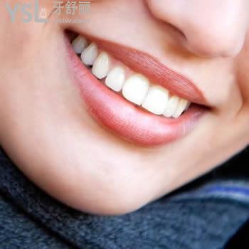 南寧柏樂口腔韓國登騰種植體多少錢？