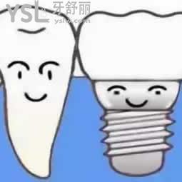 深圳格倫菲爾口腔美國皓圣種植牙收費(fèi)怎么樣？