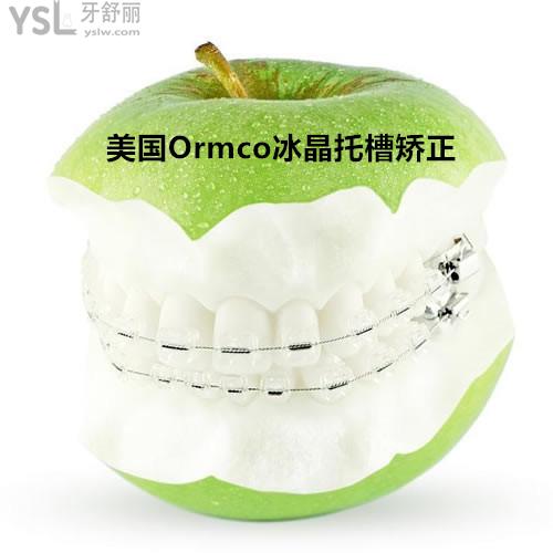 南寧柏樂口腔美國Ormco冰晶托槽矯正價格貴不貴？