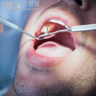 深圳正夫口腔激光種植牙收費怎么樣