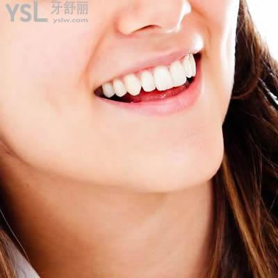 深圳雷蕾口腔陶瓷自鎖托槽矯正價格貴嗎？