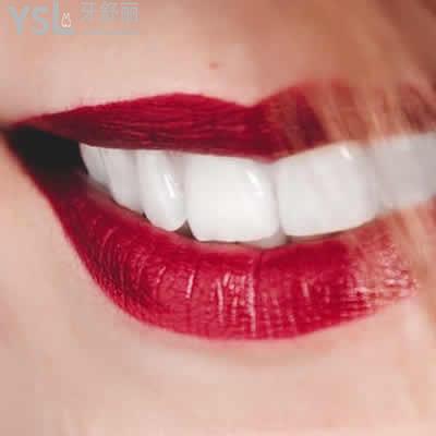 昆明長(zhǎng)鵬口腔超聲波洗牙收費(fèi)標(biāo)準(zhǔn)來(lái)襲
