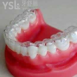 深圳拜爾齒科隱形牙齒矯正收費怎么樣