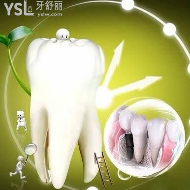 韓國奧齒泰OSSTEM種植牙質(zhì)量怎么樣？廣安金典口腔奧齒泰種植體價格為什么比較便宜？