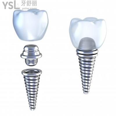 廣州雅度口腔看牙貴不貴？告知廣州雅度口腔德國(guó)ANKYLOS種植系統(tǒng)價(jià)格表