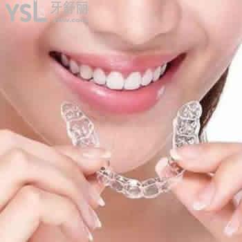 有一份西安畫美牙科時代天使正畸價(jià)格表及顧客評價(jià)參考