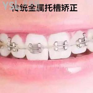 南京雅康口腔醫(yī)院正規(guī)嗎？南京雅康口腔金屬托槽矯正收費(fèi)標(biāo)準(zhǔn)